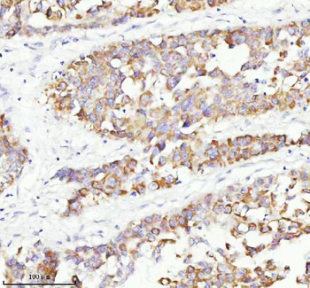 RGL3 Rabbit Polyclonal Antibody