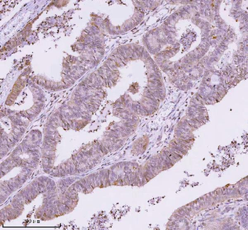RBBP8 Rabbit Polyclonal Antibody
