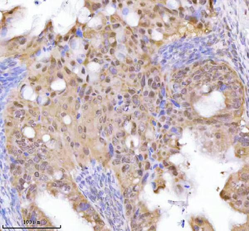 RBBP8 Rabbit Polyclonal Antibody