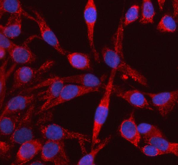 DKK3/RIG Rabbit Polyclonal Antibody