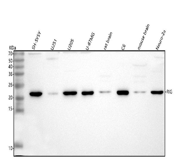 DKK3/RIG Rabbit Polyclonal Antibody