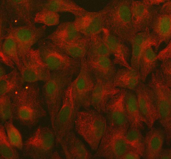 RANBP9 Rabbit Polyclonal Antibody