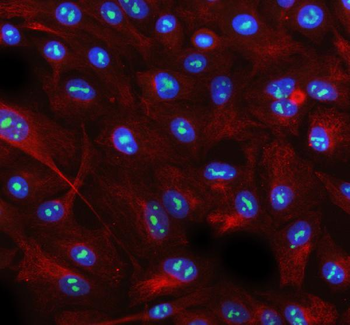 AATF Rabbit Polyclonal Antibody