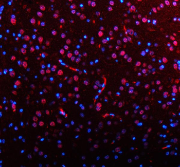 AATF Rabbit Polyclonal Antibody