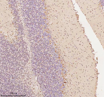 AATF Rabbit Polyclonal Antibody