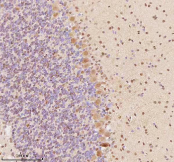 AATF Rabbit Polyclonal Antibody