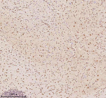 AATF Rabbit Polyclonal Antibody