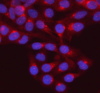 GNAI2 Rabbit Polyclonal Antibody