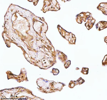 GNAI2 Rabbit Polyclonal Antibody