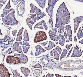 NPTX2 Rabbit Polyclonal Antibody