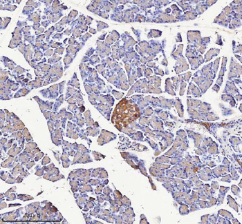 NPTX2 Rabbit Polyclonal Antibody