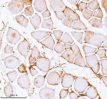 PFKM Rabbit Polyclonal Antibody