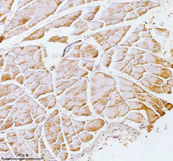 PFKM Rabbit Polyclonal Antibody