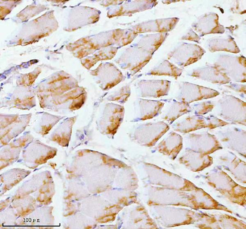 PFKM Rabbit Polyclonal Antibody