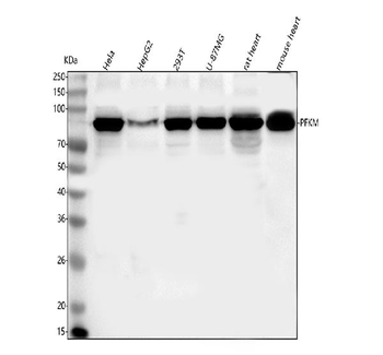 PFKM Rabbit Polyclonal Antibody