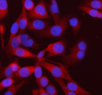PFKM Rabbit Polyclonal Antibody