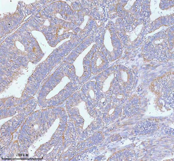 PFKM Rabbit Polyclonal Antibody