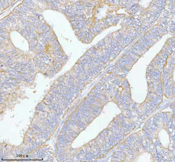 PFKM Rabbit Polyclonal Antibody
