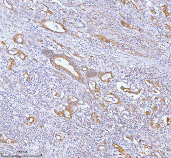 PFKM Rabbit Polyclonal Antibody