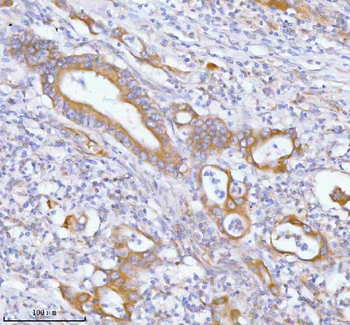 PFKM Rabbit Polyclonal Antibody