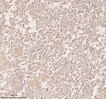 PFKM Rabbit Polyclonal Antibody