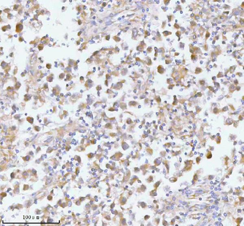 PFKM Rabbit Polyclonal Antibody