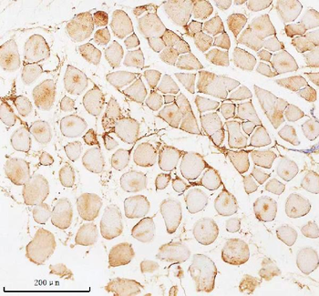 PFKM Rabbit Polyclonal Antibody