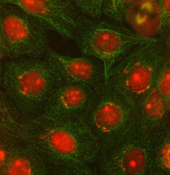 OTUD5 Rabbit Polyclonal Antibody