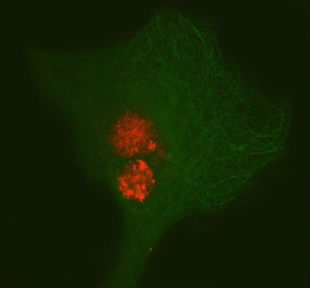PAX3 Rabbit Polyclonal Antibody