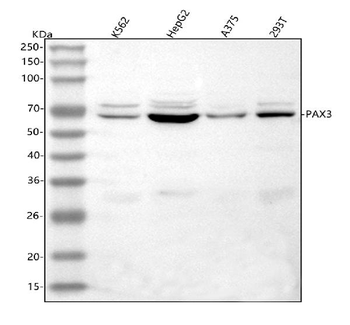 PAX3 Rabbit Polyclonal Antibody