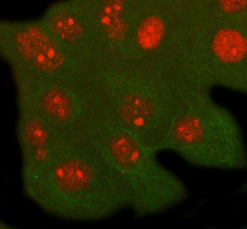 RFXANK Rabbit Polyclonal Antibody