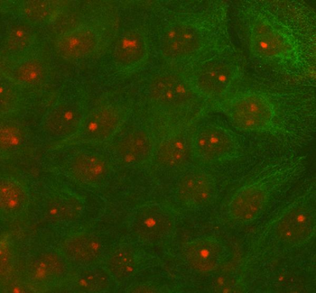 RAD51D Rabbit Polyclonal Antibody