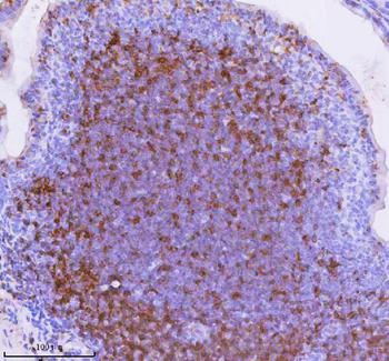 Lat Rabbit Polyclonal Antibody