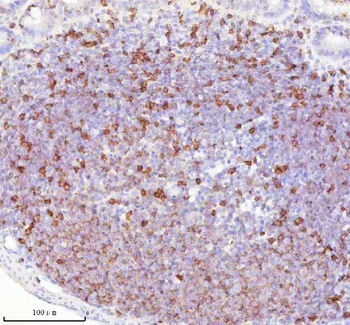 Lat Rabbit Polyclonal Antibody