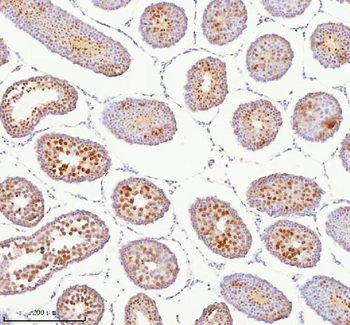 BCCIP Rabbit Polyclonal Antibody