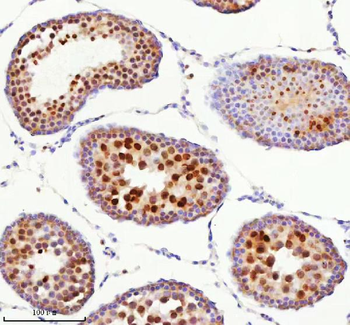 BCCIP Rabbit Polyclonal Antibody