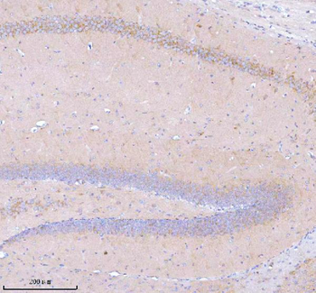 STXBP6 Rabbit Polyclonal Antibody