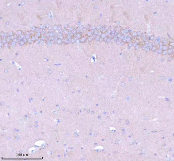 STXBP6 Rabbit Polyclonal Antibody
