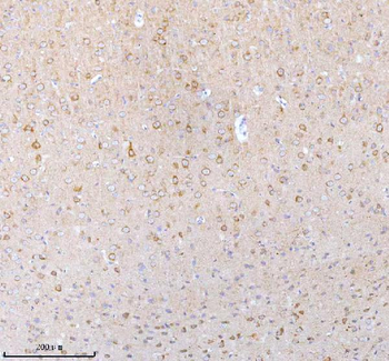 STXBP6 Rabbit Polyclonal Antibody