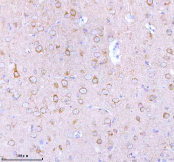 STXBP6 Rabbit Polyclonal Antibody