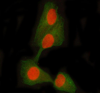 STAT5A/B Rabbit Polyclonal Antibody