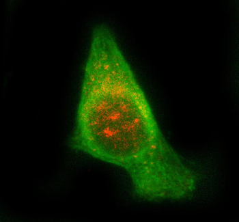 STAM2 Rabbit Polyclonal Antibody