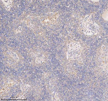 SSX2IP Rabbit Polyclonal Antibody