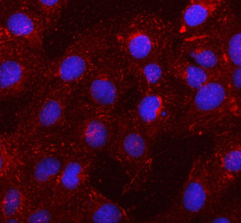 SSH1 Rabbit Polyclonal Antibody