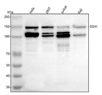 SSH1 Rabbit Polyclonal Antibody