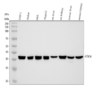 STK16 Rabbit Polyclonal Antibody