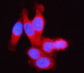 SSSCA1/ZNRD2 Rabbit Polyclonal Antibody
