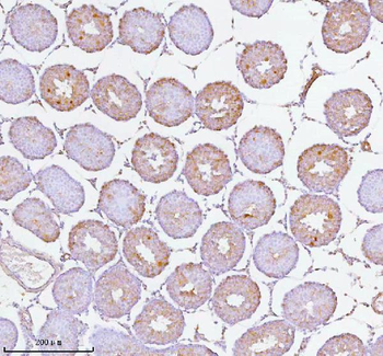 SOAT1 Rabbit Polyclonal Antibody