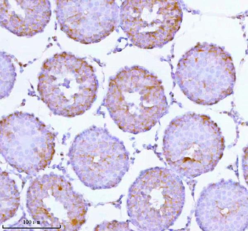 SOAT1 Rabbit Polyclonal Antibody