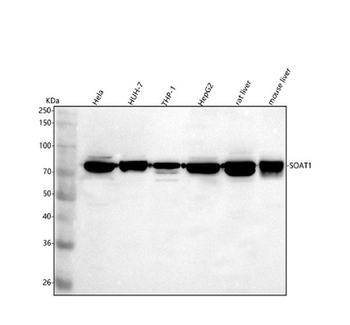 SOAT1 Rabbit Polyclonal Antibody